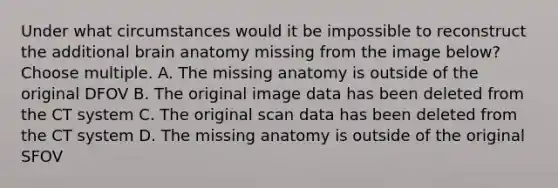 Under what circumstances would it be impossible to reconstruct the additional brain anatomy missing from the image below? Choose multiple. A. The missing anatomy is outside of the original DFOV B. The original image data has been deleted from the CT system C. The original scan data has been deleted from the CT system D. The missing anatomy is outside of the original SFOV