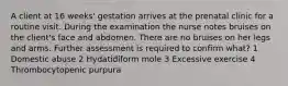 A client at 16 weeks' gestation arrives at the prenatal clinic for a routine visit. During the examination the nurse notes bruises on the client's face and abdomen. There are no bruises on her legs and arms. Further assessment is required to confirm what? 1 Domestic abuse 2 Hydatidiform mole 3 Excessive exercise 4 Thrombocytopenic purpura