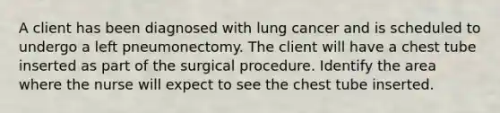 A client has been diagnosed with lung cancer and is scheduled to undergo a left pneumonectomy. The client will have a chest tube inserted as part of the surgical procedure. Identify the area where the nurse will expect to see the chest tube inserted.