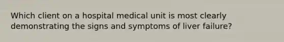 Which client on a hospital medical unit is most clearly demonstrating the signs and symptoms of liver failure?