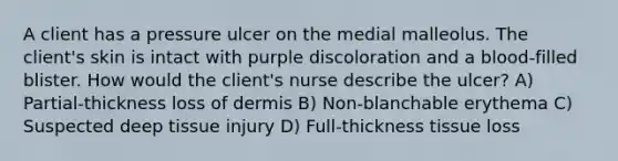 A client has a pressure ulcer on the medial malleolus. The client's skin is intact with purple discoloration and a blood-filled blister. How would the client's nurse describe the ulcer? A) Partial-thickness loss of dermis B) Non-blanchable erythema C) Suspected deep tissue injury D) Full-thickness tissue loss