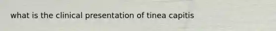 what is the clinical presentation of tinea capitis