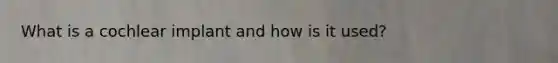 What is a cochlear implant and how is it used?