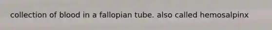 collection of blood in a fallopian tube. also called hemosalpinx
