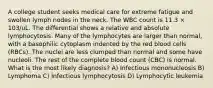 A college student seeks medical care for extreme fatigue and swollen lymph nodes in the neck. The WBC count is 11.3 × 103/uL. The differential shows a relative and absolute lymphocytosis. Many of the lymphocytes are larger than normal, with a basophilic cytoplasm indented by the red blood cells (RBCs). The nuclei are less clumped than normal and some have nucleoli. The rest of the complete blood count (CBC) is normal. What is the most likely diagnosis? A) Infectious mononucleosis B) Lymphoma C) Infectious lymphocytosis D) Lymphocytic leukemia