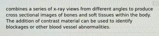 combines a series of x-ray views from different angles to produce cross sectional images of bones and soft tissues within the body. The addition of contrast material can be used to identify blockages or other blood vessel abnormalities.