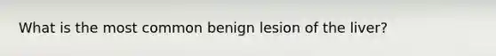 What is the most common benign lesion of the liver?