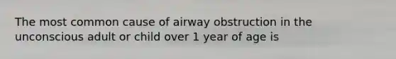 The most common cause of airway obstruction in the unconscious adult or child over 1 year of age is