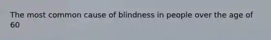 The most common cause of blindness in people over the age of 60