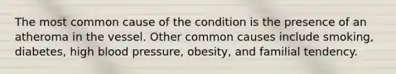 The most common cause of the condition is the presence of an atheroma in the vessel. Other common causes include smoking, diabetes, high blood pressure, obesity, and familial tendency.