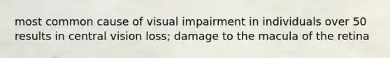 most common cause of visual impairment in individuals over 50 results in central vision loss; damage to the macula of the retina