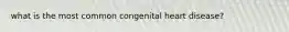 what is the most common congenital heart disease?