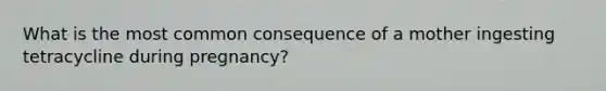 What is the most common consequence of a mother ingesting tetracycline during pregnancy?