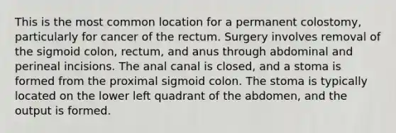 This is the most common location for a permanent colostomy, particularly for cancer of the rectum. Surgery involves removal of the sigmoid colon, rectum, and anus through abdominal and perineal incisions. The anal canal is closed, and a stoma is formed from the proximal sigmoid colon. The stoma is typically located on the lower left quadrant of the abdomen, and the output is formed.