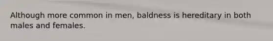 Although more common in men, baldness is hereditary in both males and females.