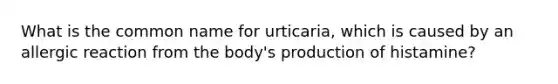 What is the common name for urticaria, which is caused by an allergic reaction from the body's production of histamine?