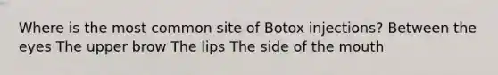 Where is the most common site of Botox injections? Between the eyes The upper brow The lips The side of the mouth