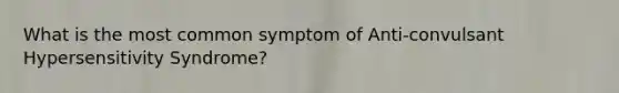 What is the most common symptom of Anti-convulsant Hypersensitivity Syndrome?