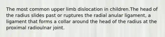 The most common upper limb dislocation in children.The head of the radius slides past or ruptures the radial anular ligament, a ligament that forms a collar around the head of the radius at the proximal radioulnar joint.