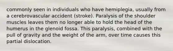 commonly seen in individuals who have hemiplegia, usually from a cerebrovascular accident (stroke). Paralysis of the shoulder muscles leaves them no longer able to hold the head of the humerus in the glenoid fossa. This paralysis, combined with the pull of gravity and the weight of the arm, over time causes this partial dislocation.