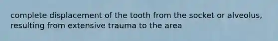 complete displacement of the tooth from the socket or alveolus, resulting from extensive trauma to the area