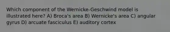 Which component of the Wernicke-Geschwind model is illustrated here? A) Broca's area B) Wernicke's area C) angular gyrus D) arcuate fasciculus E) auditory cortex