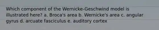 Which component of the Wernicke-Geschwind model is illustrated here? a. Broca's area b. Wernicke's area c. angular gyrus d. arcuate fasciculus e. auditory cortex