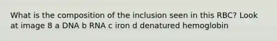 What is the composition of the inclusion seen in this RBC? Look at image 8 a DNA b RNA c iron d denatured hemoglobin