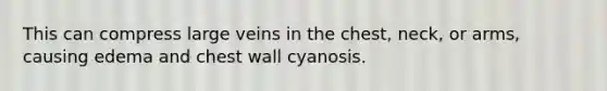 This can compress large veins in the chest, neck, or arms, causing edema and chest wall cyanosis.