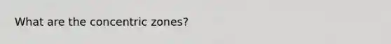 What are the concentric zones?