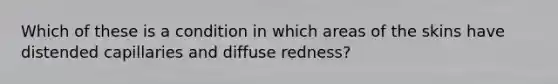 Which of these is a condition in which areas of the skins have distended capillaries and diffuse redness?