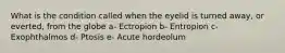 What is the condition called when the eyelid is turned away, or everted, from the globe a- Ectropion b- Entropion c- Exophthalmos d- Ptosis e- Acute hordeolum