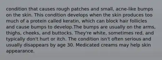 condition that causes rough patches and small, acne-like bumps on the skin. This condition develops when the skin produces too much of a protein called keratin, which can block hair follicles and cause bumps to develop.The bumps are usually on the arms, thighs, cheeks, and buttocks. They're white, sometimes red, and typically don't hurt or itch. The condition isn't often serious and usually disappears by age 30. Medicated creams may help skin appearance.