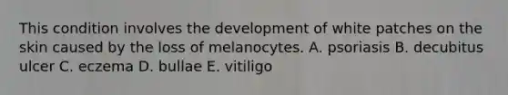 This condition involves the development of white patches on the skin caused by the loss of melanocytes. A. psoriasis B. decubitus ulcer C. eczema D. bullae E. vitiligo