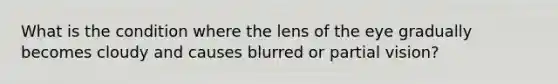 What is the condition where the lens of the eye gradually becomes cloudy and causes blurred or partial vision?