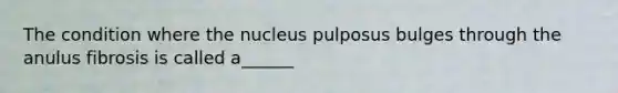 The condition where the nucleus pulposus bulges through the anulus fibrosis is called a______