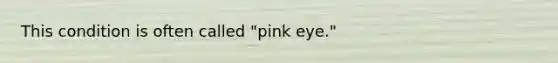 This condition is often called "pink eye."