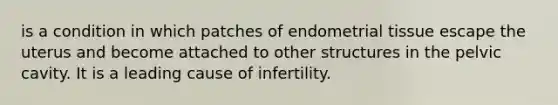 is a condition in which patches of endometrial tissue escape the uterus and become attached to other structures in the pelvic cavity. It is a leading cause of infertility.