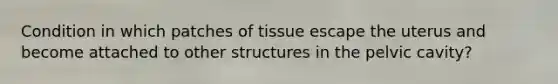 Condition in which patches of tissue escape the uterus and become attached to other structures in the pelvic cavity?