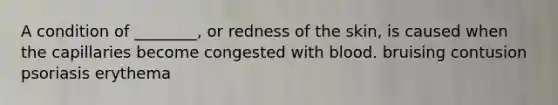 A condition of ________, or redness of the skin, is caused when the capillaries become congested with blood. bruising contusion psoriasis erythema