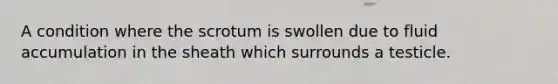 A condition where the scrotum is swollen due to fluid accumulation in the sheath which surrounds a testicle.