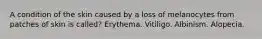 A condition of the skin caused by a loss of melanocytes from patches of skin is called? Erythema. Vitiligo. Albinism. Alopecia.