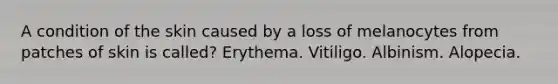 A condition of the skin caused by a loss of melanocytes from patches of skin is called? Erythema. Vitiligo. Albinism. Alopecia.