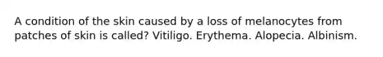 A condition of the skin caused by a loss of melanocytes from patches of skin is called? Vitiligo. Erythema. Alopecia. Albinism.