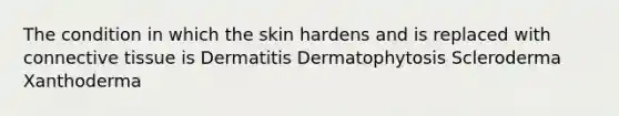 The condition in which the skin hardens and is replaced with connective tissue is Dermatitis Dermatophytosis Scleroderma Xanthoderma