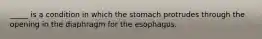 _____ is a condition in which the stomach protrudes through the opening in the diaphragm for the esophagus.