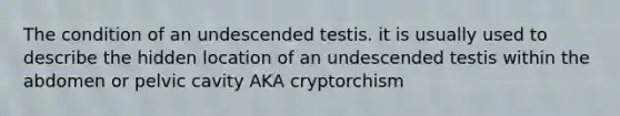 The condition of an undescended testis. it is usually used to describe the hidden location of an undescended testis within the abdomen or pelvic cavity AKA cryptorchism