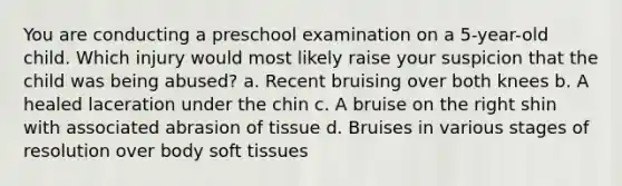 You are conducting a preschool examination on a 5-year-old child. Which injury would most likely raise your suspicion that the child was being abused? a. Recent bruising over both knees b. A healed laceration under the chin c. A bruise on the right shin with associated abrasion of tissue d. Bruises in various stages of resolution over body soft tissues