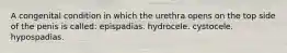 A congenital condition in which the urethra opens on the top side of the penis is called: epispadias. hydrocele. cystocele. hypospadias.