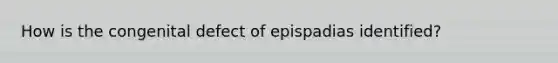 How is the congenital defect of epispadias​ identified?